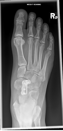 <p>same as AP Axial Foot</p>