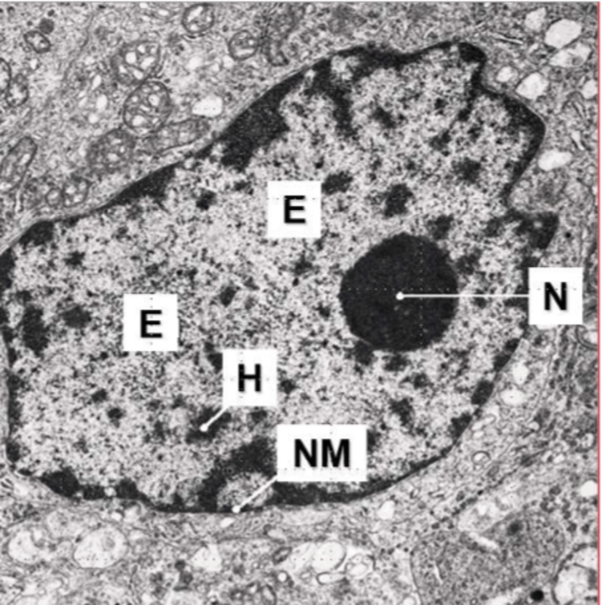 <p>1. <strong>less condensed</strong></p><p>2. <strong>light staining</strong></p><p><strong>3.</strong>Euchromatin is in a transcriptionally <strong>active state</strong></p>