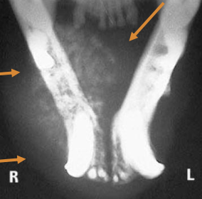 <ul><li><p>bloodwork</p></li><li><p>LN evaluation - cytology</p></li><li><p>CT imaging often needed for surgical/RT planning</p></li><li><p>thoracic imaging (rads/CT)</p></li></ul><p></p>
