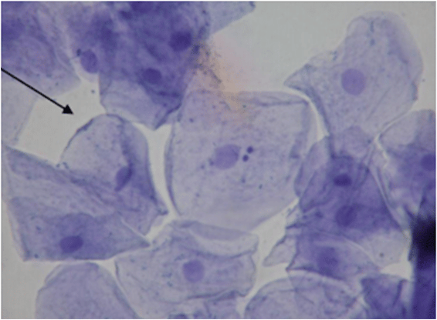 <p>What type of stain is this?</p>