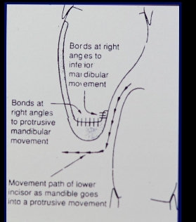 <ol><li><p>compression vs tension</p><p></p></li><li><p>Vertical stop</p><p></p></li><li><p>Vertical loading</p></li></ol><p></p>