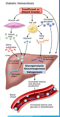 <p>can occur in Type I Diabetics when their cells don’t get a signal about there being sugar in the blood, preventing them from taking it out of the bloodstream. The cells then switch to fatty acid metabolism, producing ketones </p><p>-can cause hyperglycemia, hyperketonemia, acidosis, nausea, vomiting, abdominal pain, swelling of the brain, coma, and death</p>