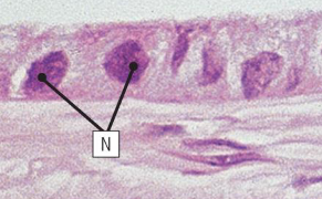 <p>what type of epithelium is shown here</p>