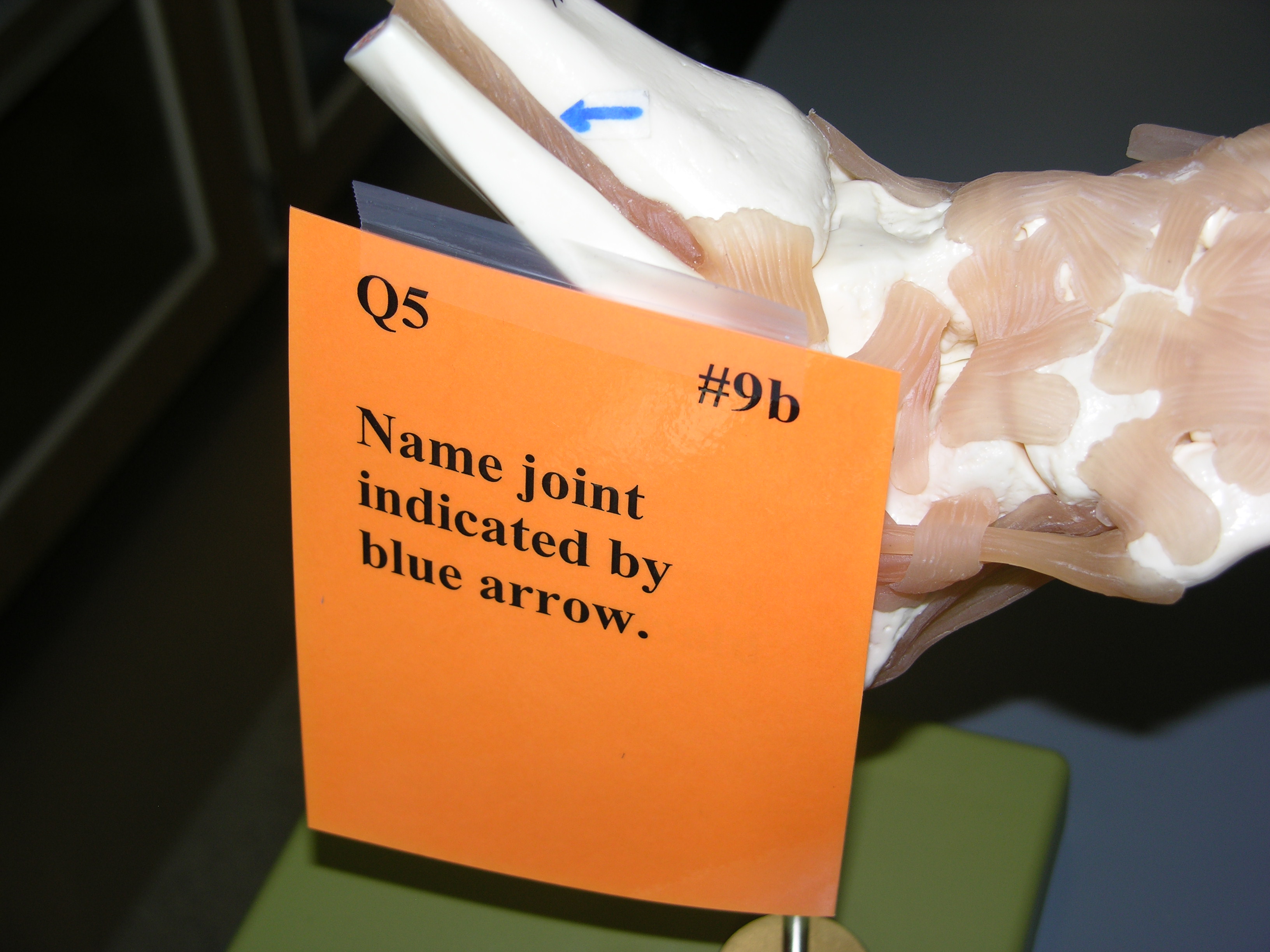 <p><span style="font-family: Lato Extended, Lato, Helvetica Neue, Helvetica, Arial, sans-serif; color: rgb(45, 59, 69)">Name the joint indicated by the blue arrow</span></p>
