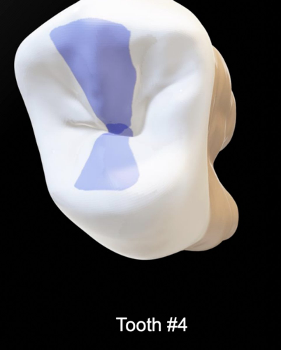 <p>goes across the tooth</p><p>buccal triangular ridge plus lingual triangular ridge</p>