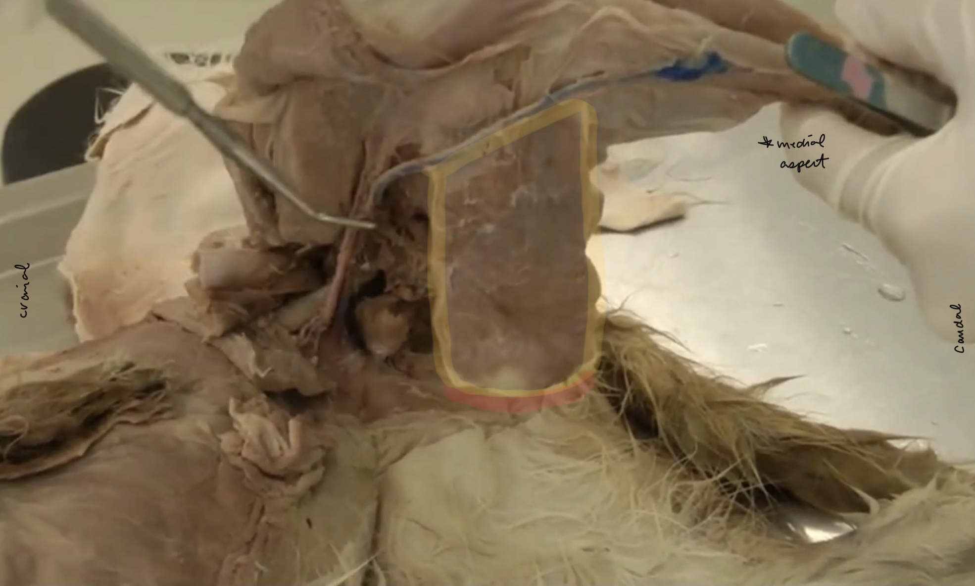 <p>What is the yellow highlighted portion?</p>