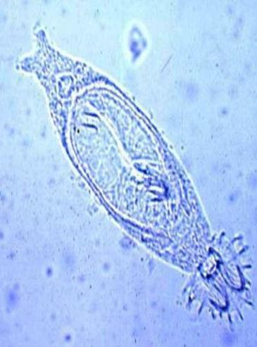 <ul><li><p>Genus</p></li><li><p>Opisthaptor is ?</p></li><li><p>Oviparous/Viviparous?</p></li><li><p># Pair of Anchor</p></li><li><p># Marginal Hooklets</p></li></ul><p></p>