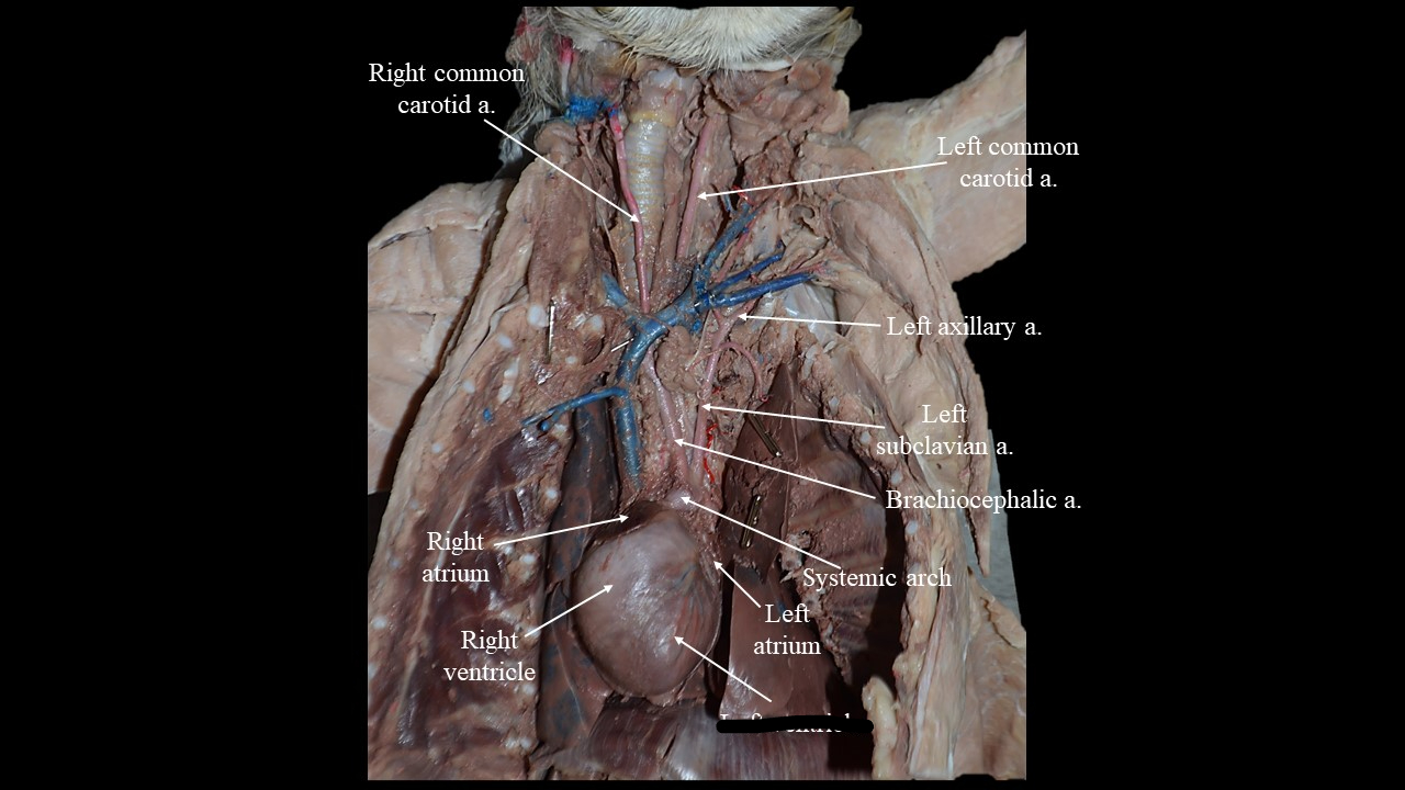 <p>pumps oxygenated blood out to the body</p>