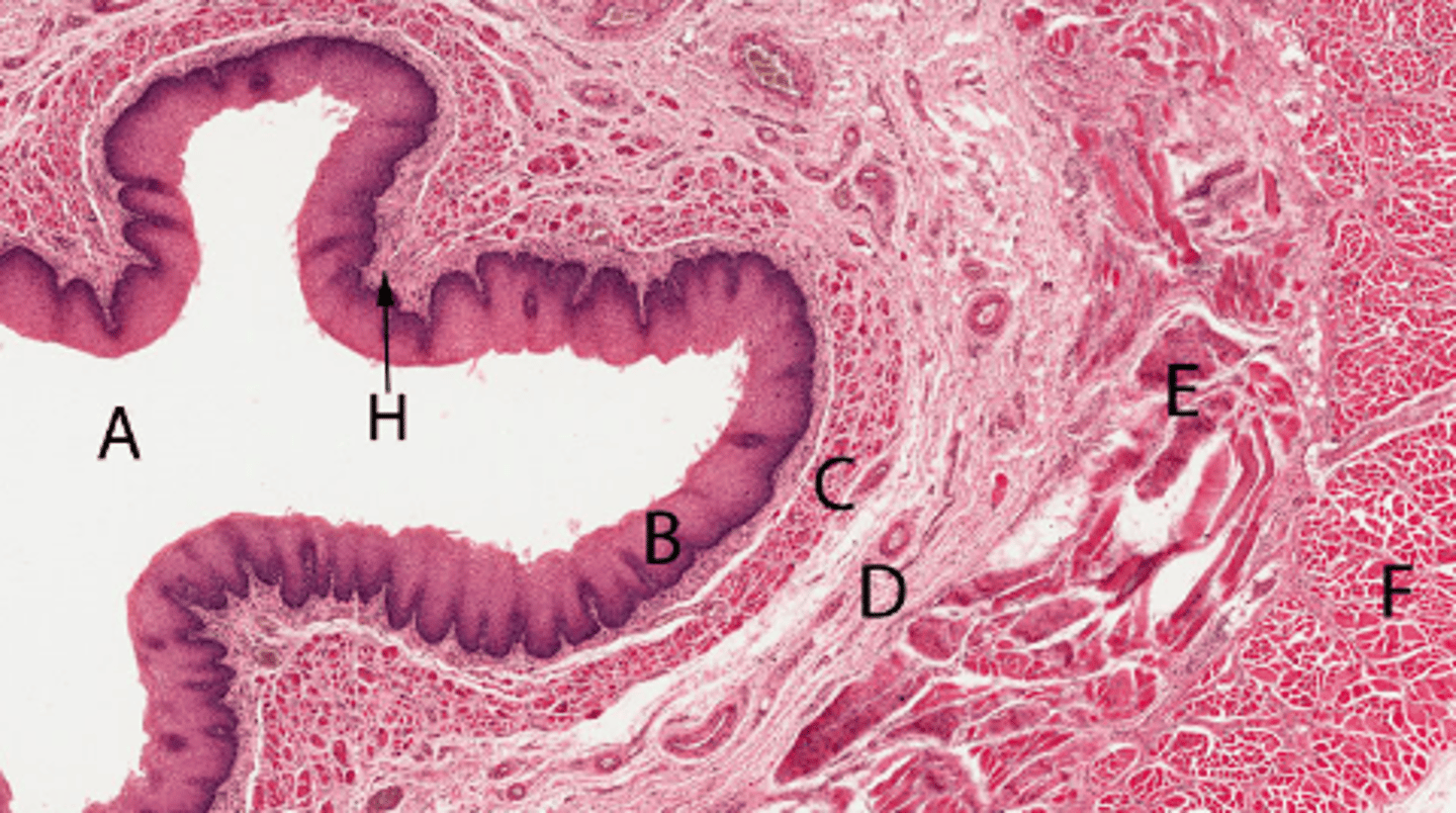 <p>Mix of skeletal and smooth muscle of circular layer</p>