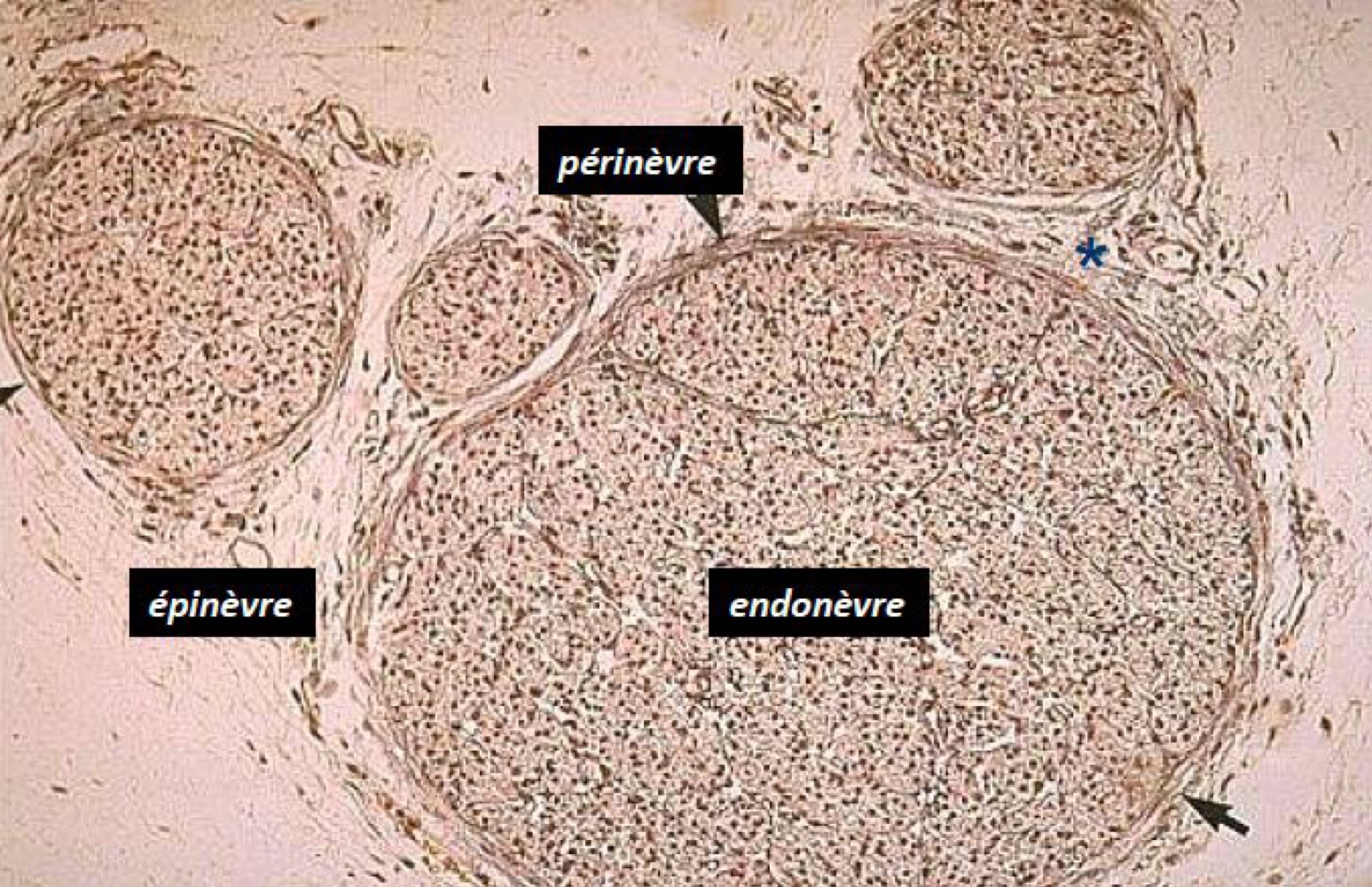 <p>Analyse la photo</p>