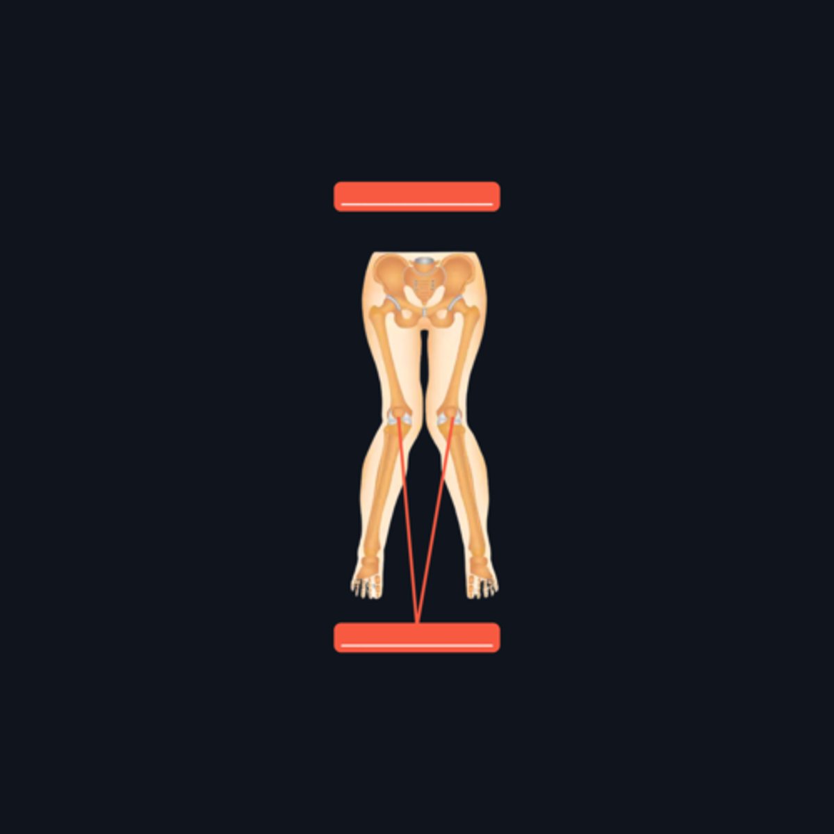 <p>Identify the knee condition pointed and what hip condition is it under?</p>