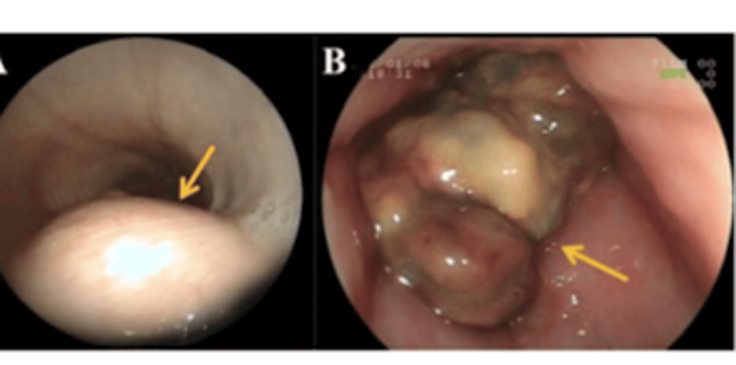 <p>what is the problem we see here?</p>