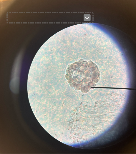 <p>hollow ball of cells</p>