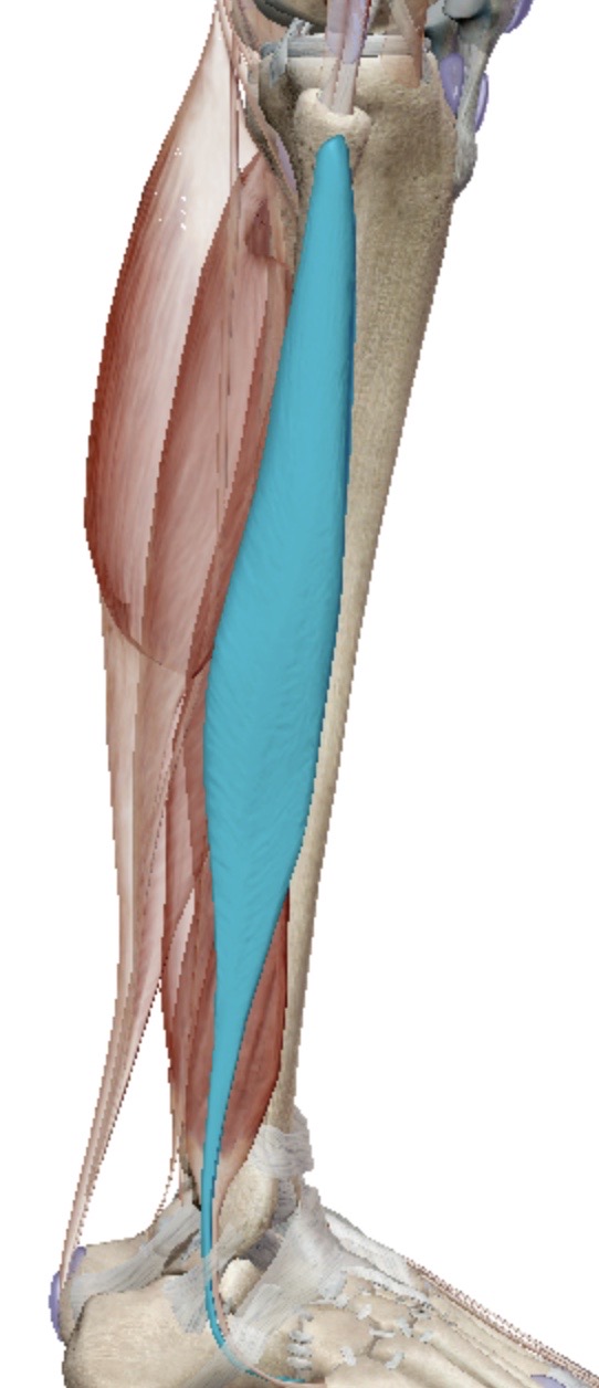 <p>Identify this muscle</p>