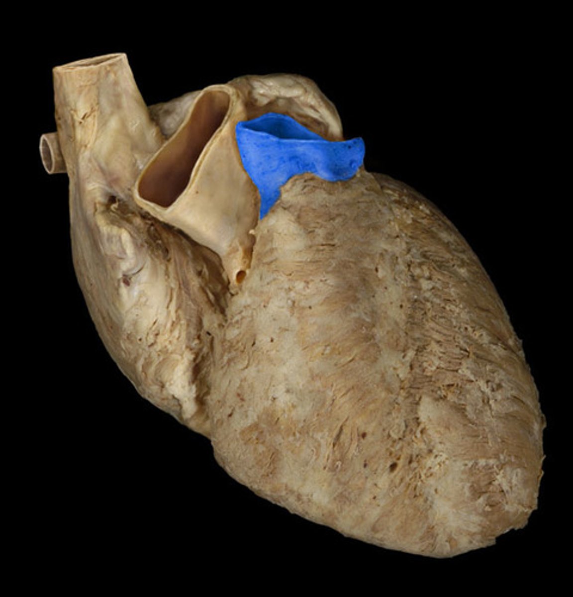 <p>artery</p>