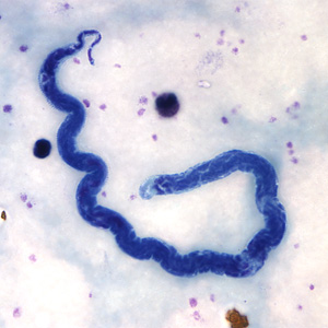 <ul><li><p>sheathed</p></li><li><p>tapered, often coiled</p></li><li><p>nuclei to tip</p></li></ul><p></p>