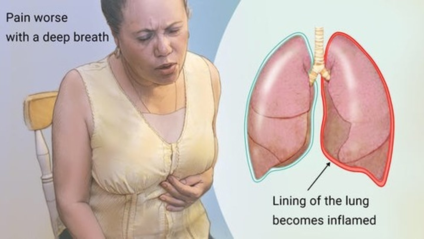 <p>- Inflammation of the visceral pleura surrounding lungs</p><p>- result in pleural friction rub</p><p>- "grating sound" or "stepping on fresh snow"</p>