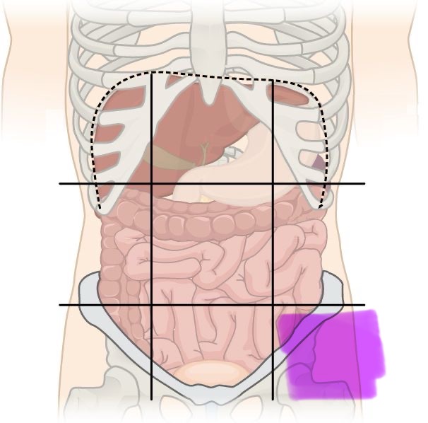 term image