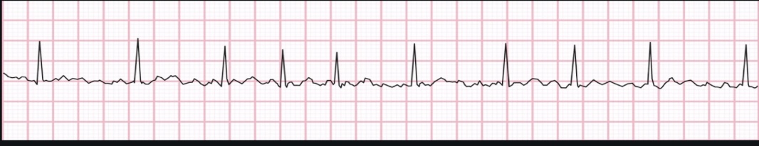 <p>ECG interpretation</p>