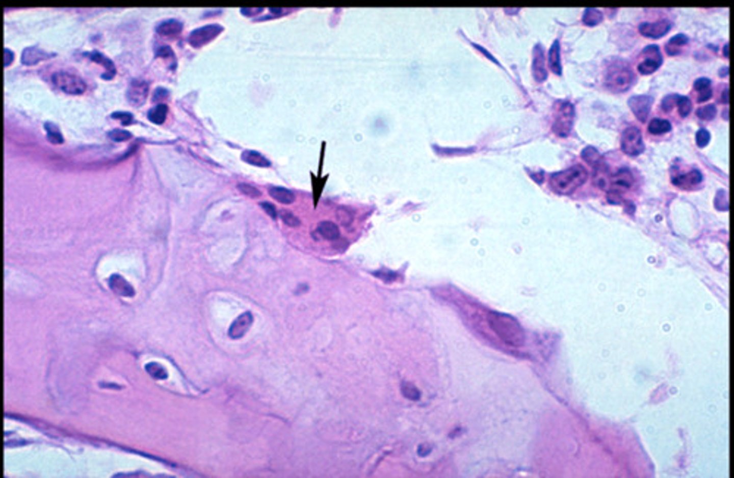 <p>large cells that resorb or break down bone matrix</p>