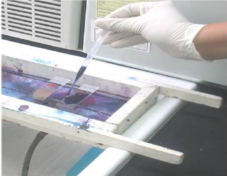 <p>Identify the method of staining blood smear</p>