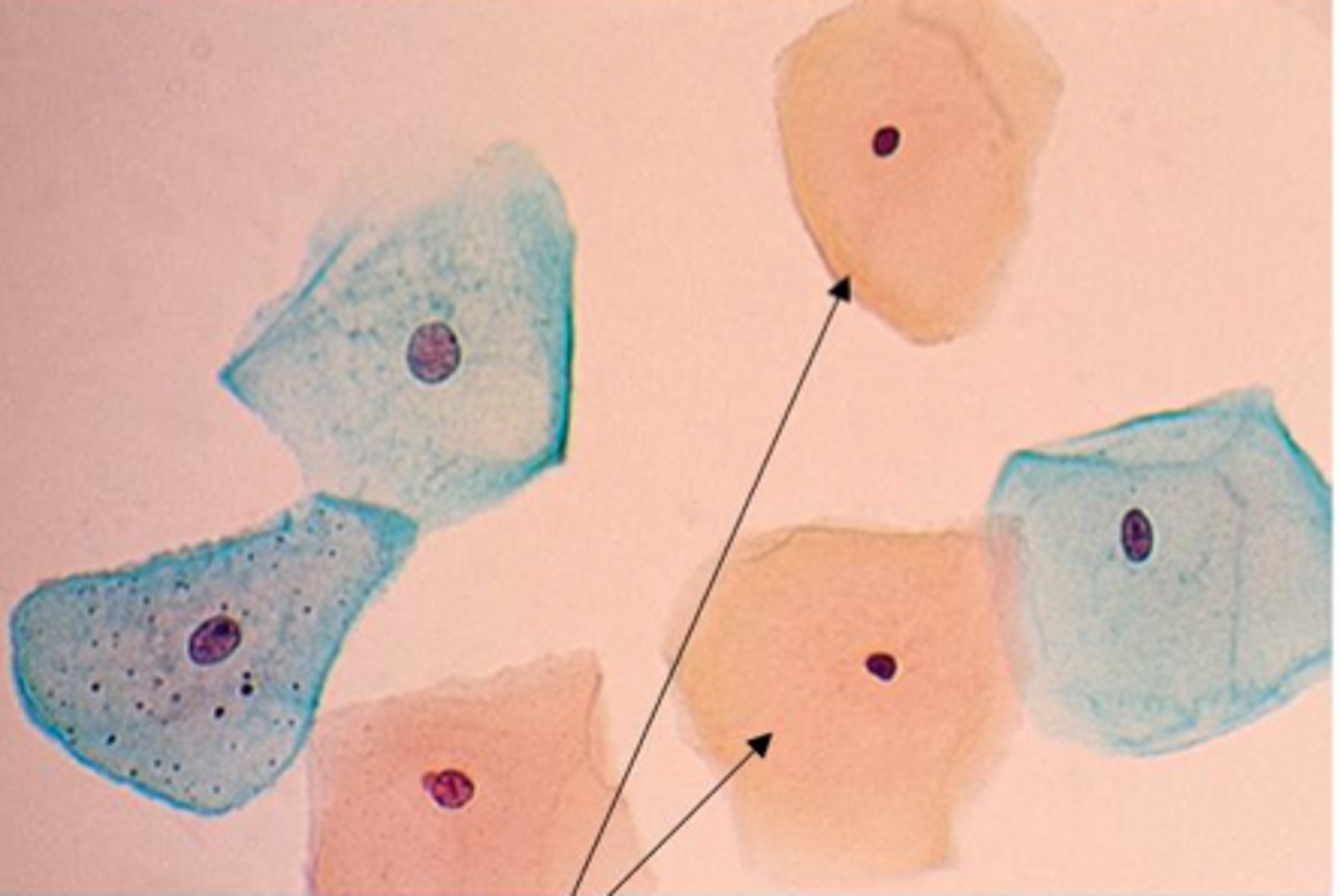 <p>Superficial epithelial cells with pyknotic nucleus</p>