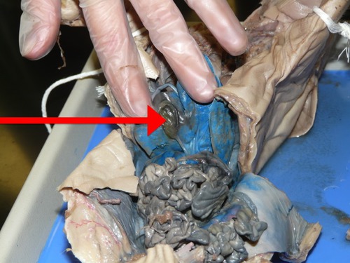 -Under the right liver lobe
-Stores bile produced in the liver
-Part of the Digestive System