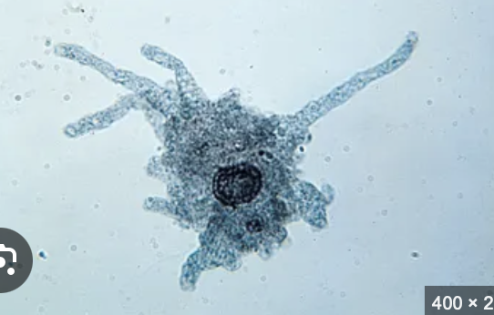<p>branching pseudopods that trap food </p>