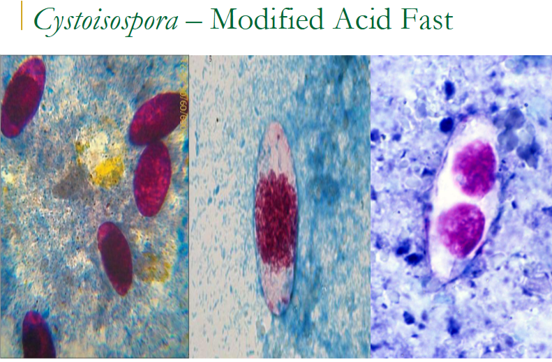 <p>cystoisospora (isospora) belli oocyst </p>