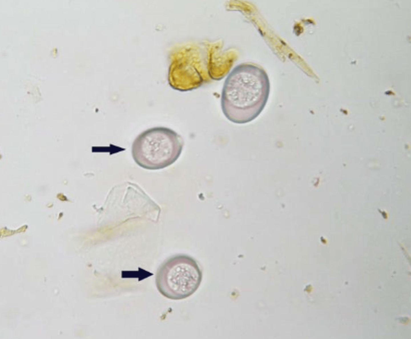 <p>protozoos apicomplejos intracelulares de los enterocitos</p>