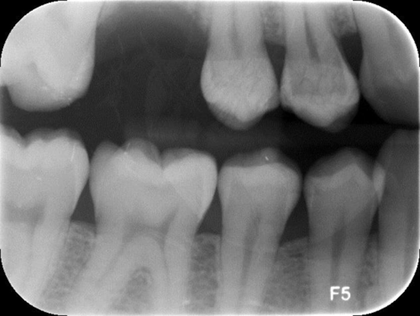 <p>What is this error?</p>