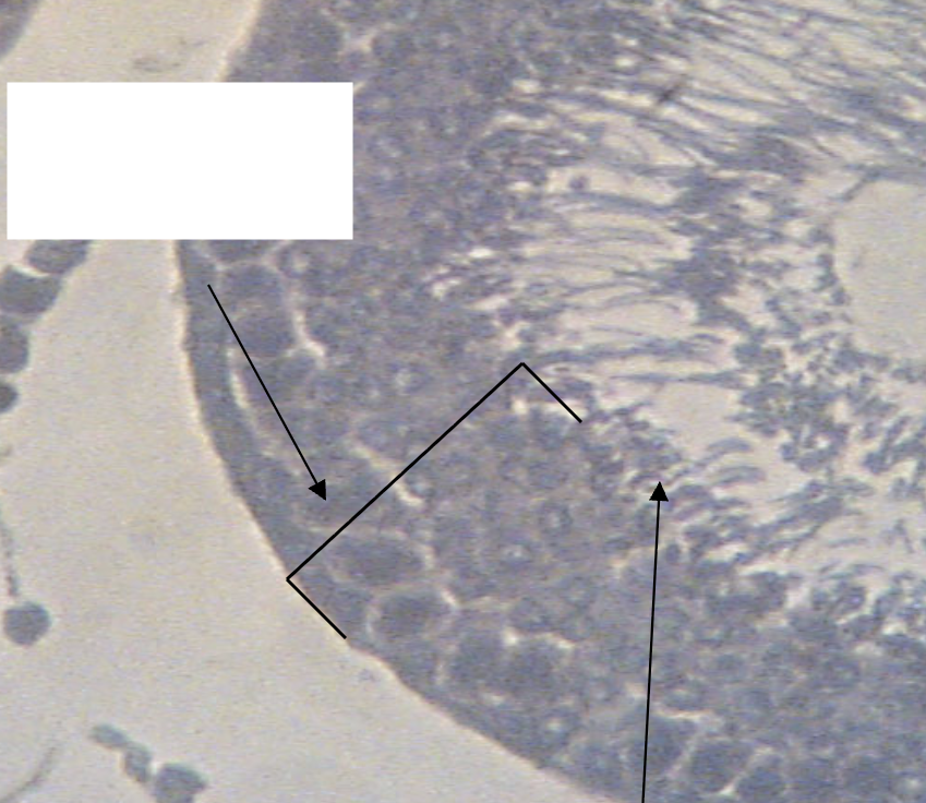 <p>What structures are being indicated by the above arrow?</p>