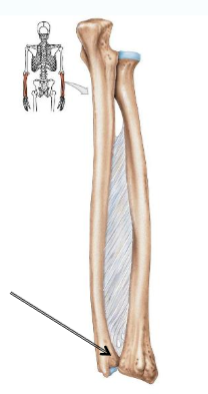 <p>Name joint </p>