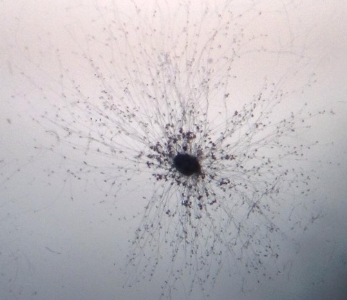 <p><span>pH usually acidic (but may be alkaline)</span></p><p style="text-align: left"><span>May be seen as fungal hyphae</span></p><p style="text-align: left"><span>Significant contamination can be seen with the naked eye</span></p><p></p>