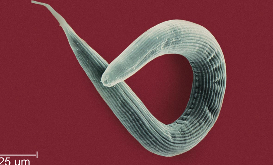 <p>Nematodes</p>
