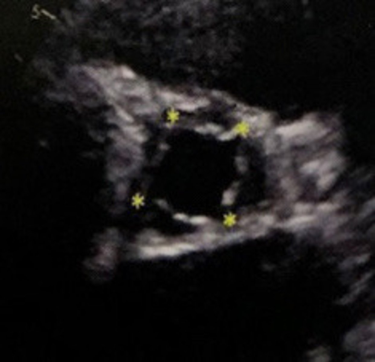 <p>What does this image represent</p>
