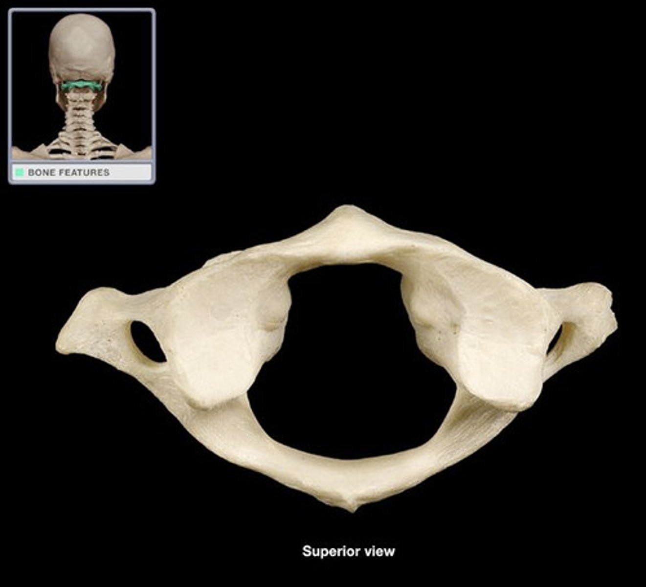 <p>- no spinous process</p><p>- no vertebral body</p><p>- has transverse process</p><p>- has transverse foramina (unique)</p><p>- has superior articular facets (rounded flat parts)</p><p>- has an anterior and posterior tubercle</p><p>- has an anterior arch</p><p>- articulates with axis (C2)</p>