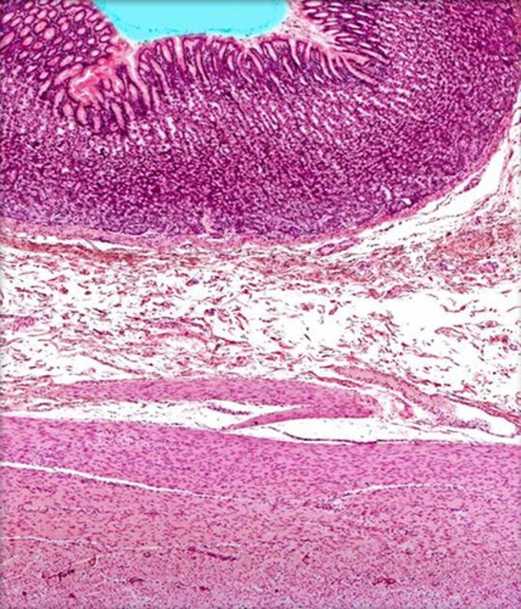 <p>Identify this open space in the GI tract.</p>