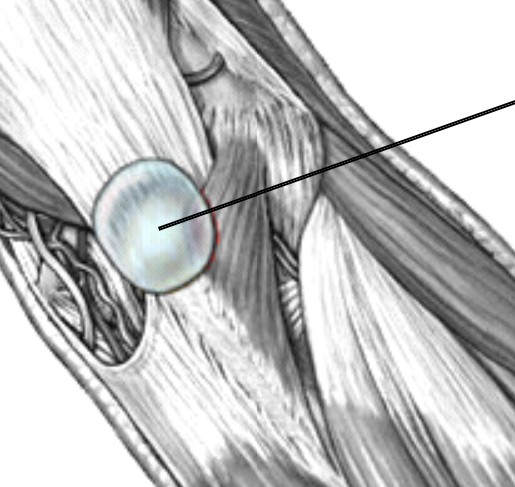 <p>Which bursa of the elbow is at the tip of elbow?</p>
