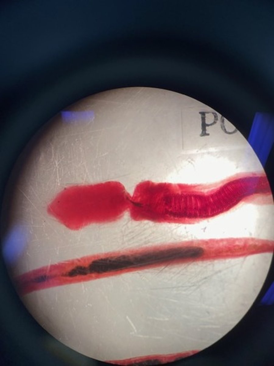 <p>What organisms does phylum Hemichordata hold?</p>