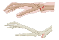 <p>dorsal (DOg) </p>