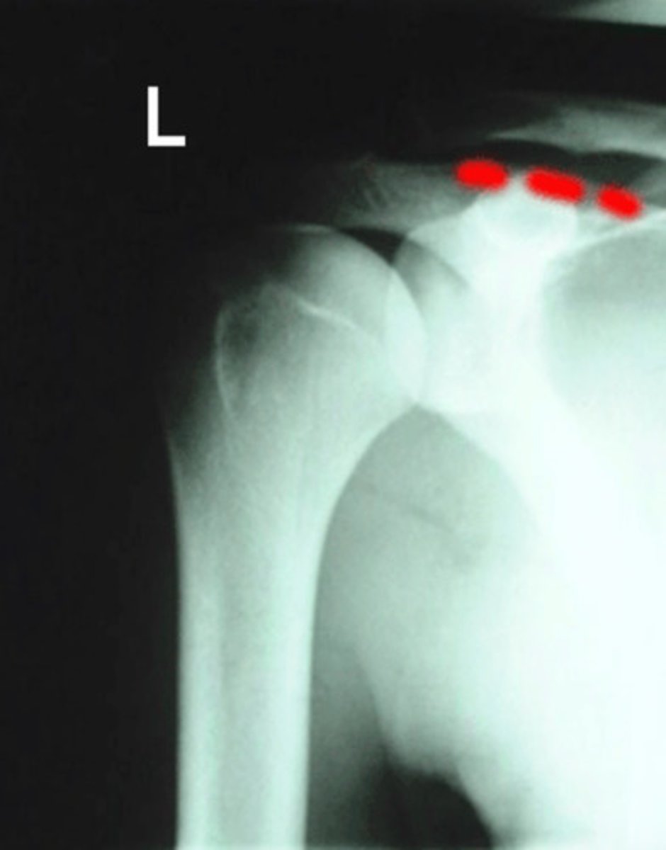 <p>What is being identified in this image?</p>