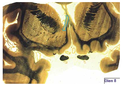<p>what is shown?</p>