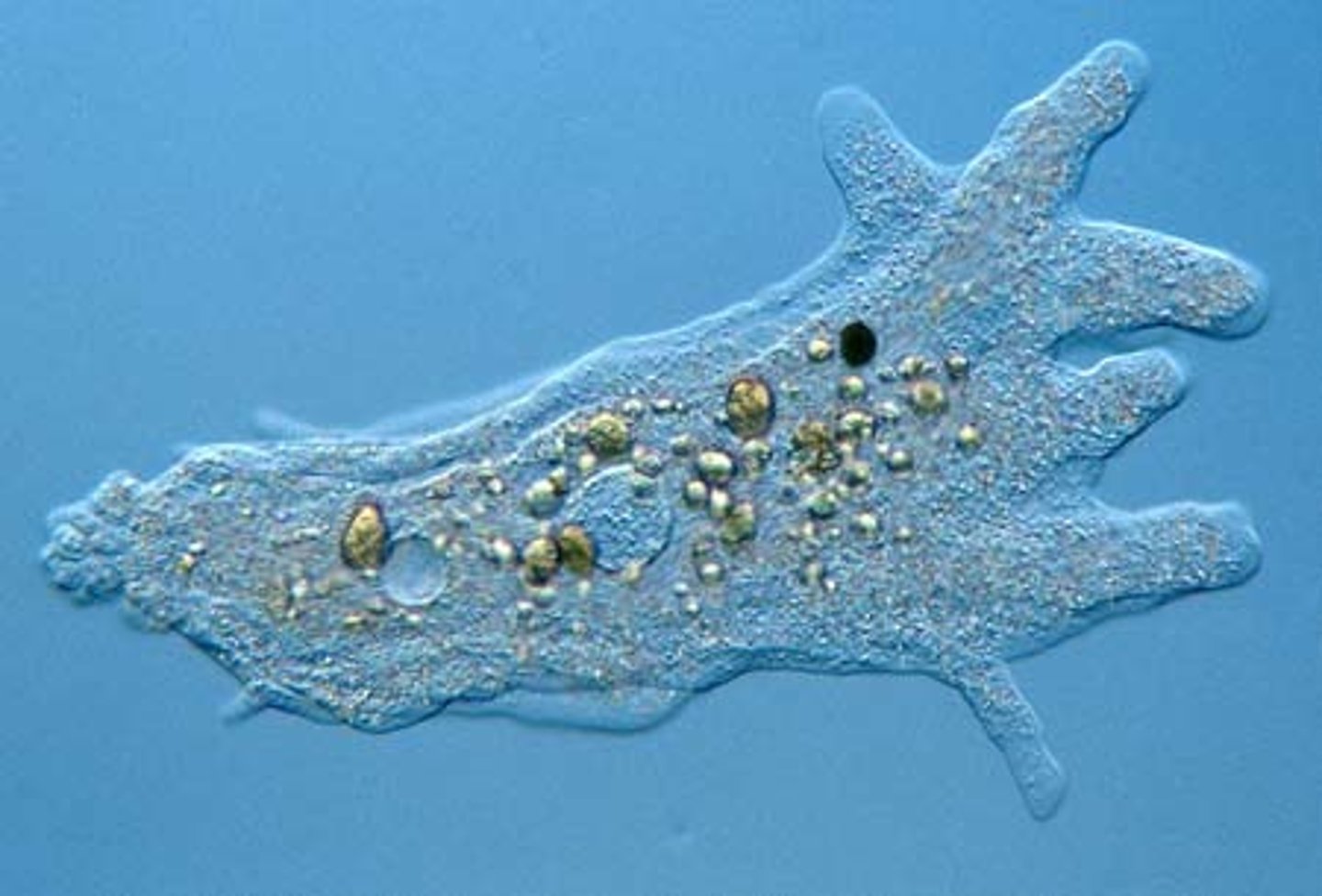 <p>-Pseudopods</p><p>Extensions of plasma membrane to create "false feet" for feeding and movement</p><p>-Heterotrophic</p><p>Ex: zooplankton</p><p>-Unicellular</p><p>-Amoeba proteus</p><p>Feed on small living bacteria + protists</p><p>Free living amoeba (no host)</p><p>Marine and freshwater</p><p>Create storage areas called vesicles</p><p>-Entamoeba (Amoebic Dysentery)</p><p>Pathogenic</p><p>Human to human</p><p>Cysts excreted in feces</p><p>fecal/oral route</p><p>Amoebic dysentery</p><p>Diarrhea, abdominal pain, etc.</p><p>-Diagnosis: microscopic identification of cysts and trophozoites in the stool</p>