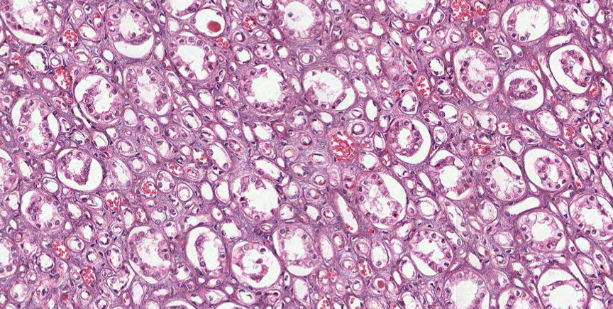 <ul><li><p>Formed when CDs merge</p></li><li><p>Drain urine from papilla to calyx</p></li></ul><p></p>