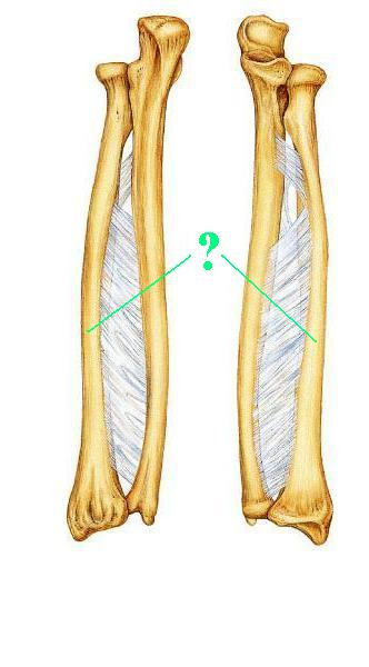 <p>Is the indicated bone from the right or left side of the body?</p>