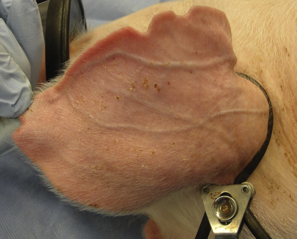 <p>What vessel is this demonstrating?</p>