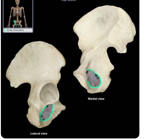 opening in hip bone formed by the pubic and ischial rami