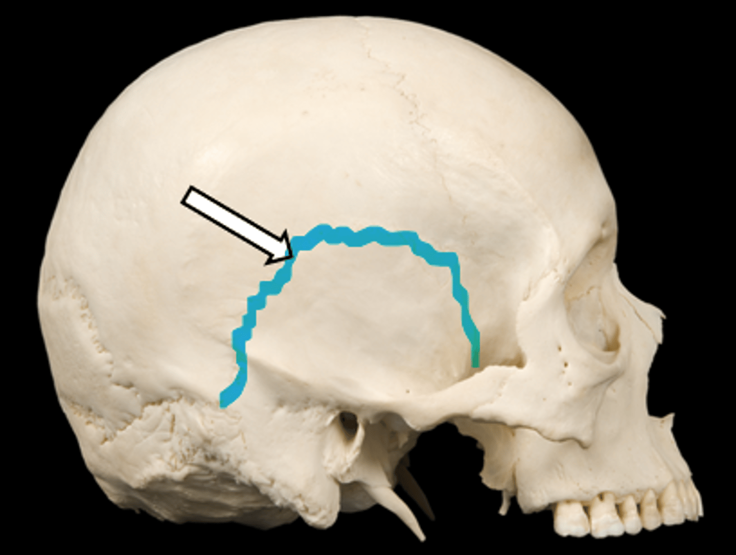 <p>name the part</p>