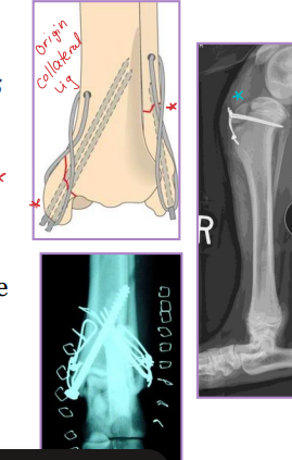<p><span style="background-color: transparent;"><strong>Tibia & fibula Fractures</strong></span></p>